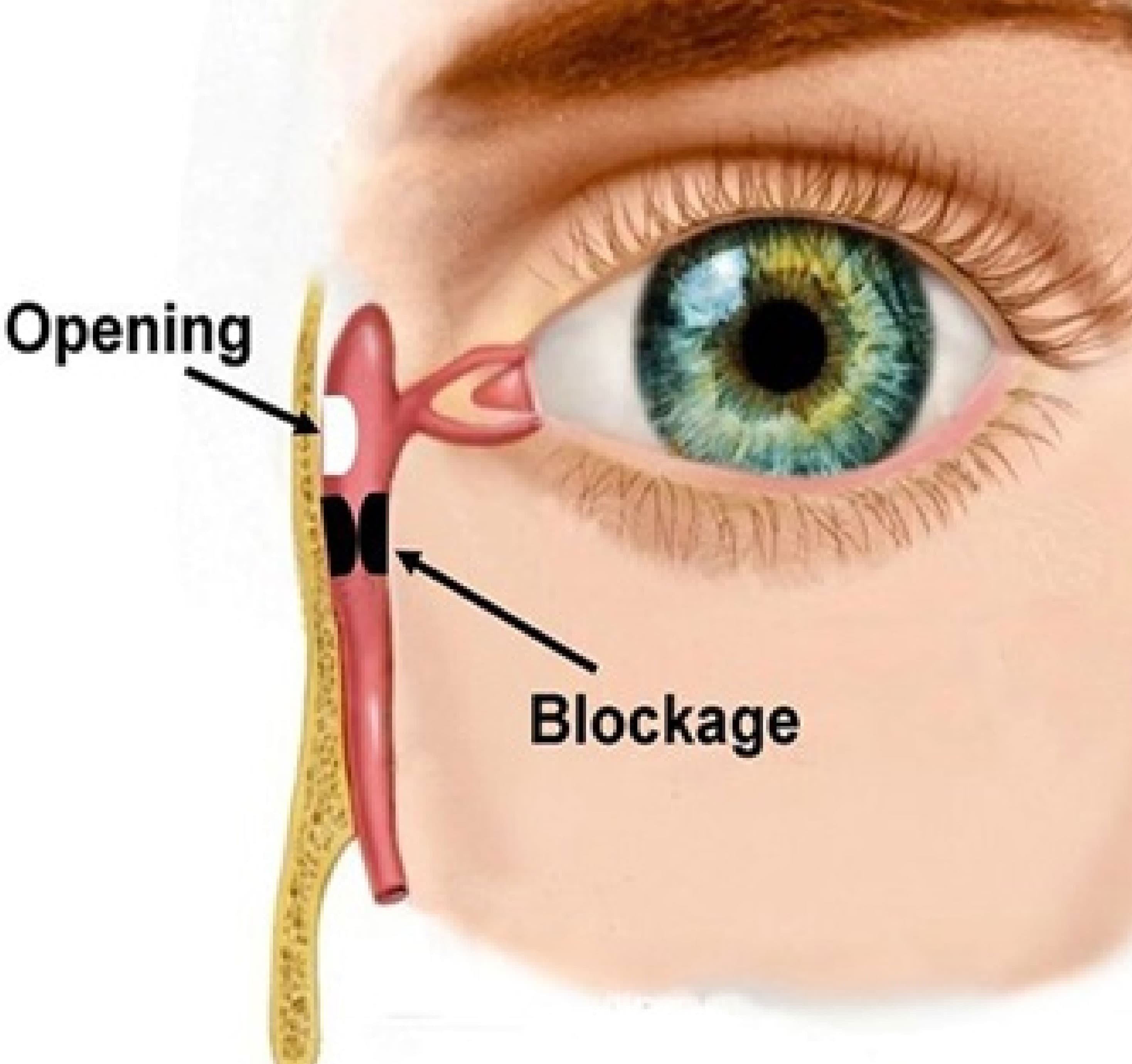 DCR and DCT surgery