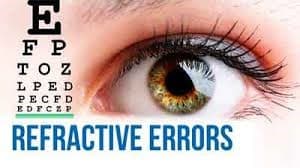 Refractive error correction